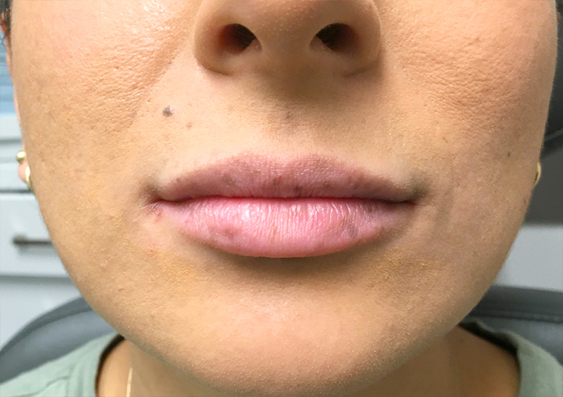 Injectables And Fillers 01