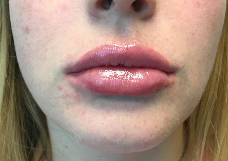 Injectables And Fillers 131