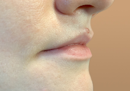 Injectables And Fillers 01