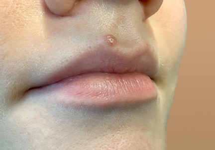 Injectables And Fillers 03