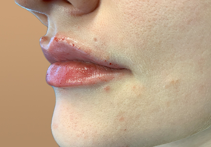 Injectables And Fillers 05