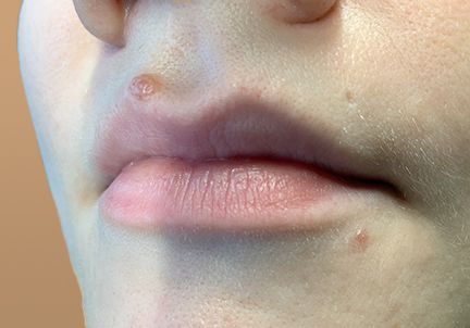 Injectables And Fillers 07