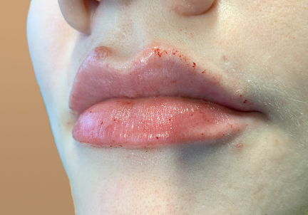 Injectables And Fillers 07