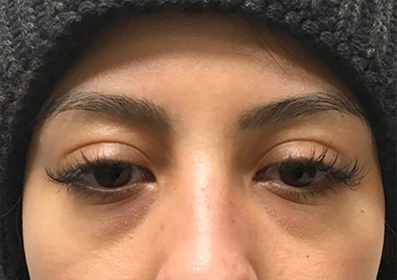 Injectables And Fillers 01