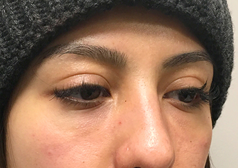 Injectables And Fillers 05