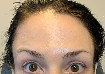 Injectables And Fillers 141