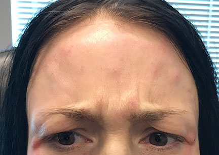 Injectables And Fillers 03