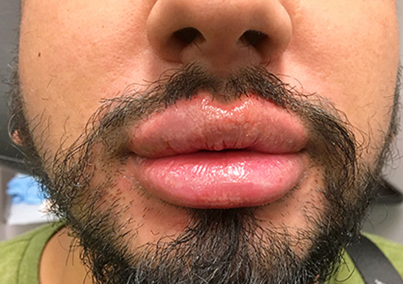 Injectables And Fillers 144