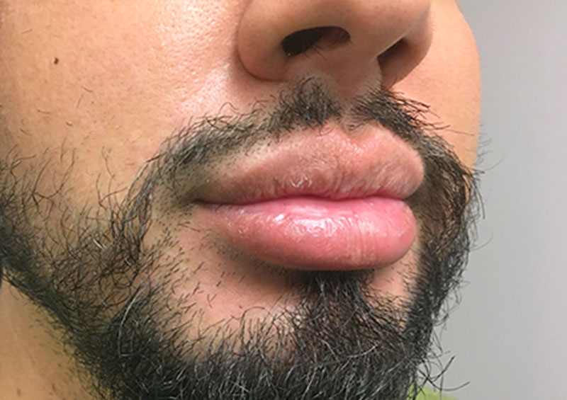 Injectables And Fillers 05