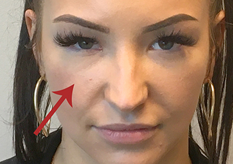 Injectables And Fillers 01