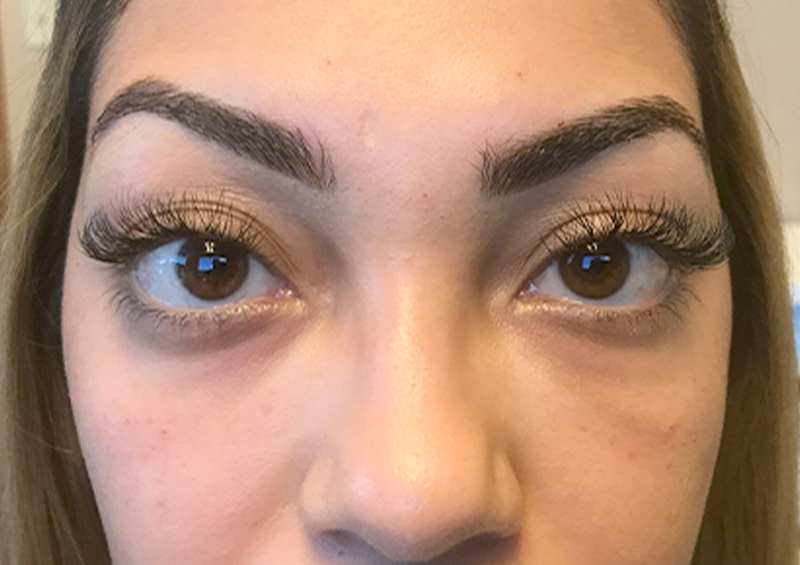 Injectables And Fillers 149