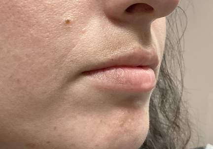 Injectables And Fillers 03