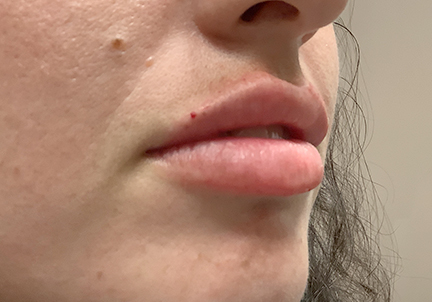 Injectables And Fillers 03