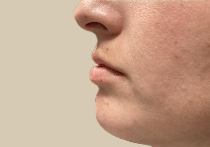 Injectables And Fillers 05