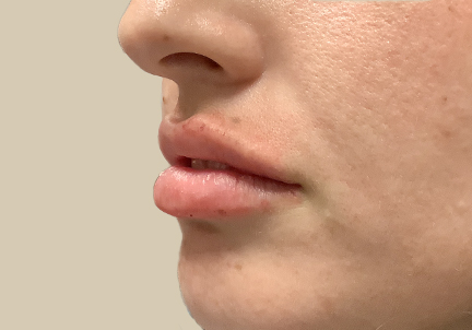 Injectables And Fillers 05