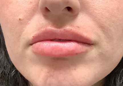 Injectables And Fillers 09