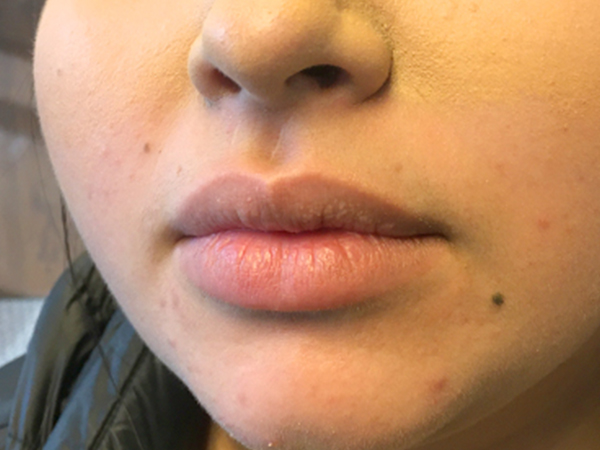 Injectables And Fillers 03