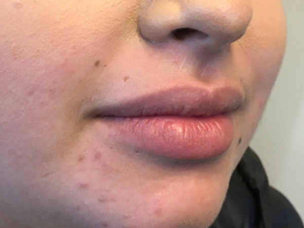 Injectables And Fillers 05