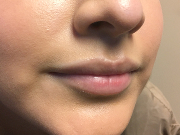 Injectables And Fillers 05