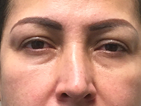 Injectables And Fillers 01