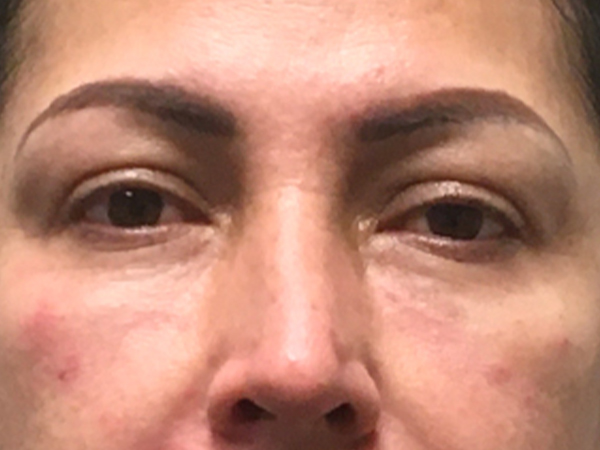 Injectables And Fillers 153