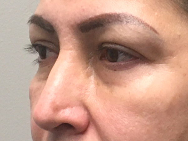 Injectables And Fillers 03