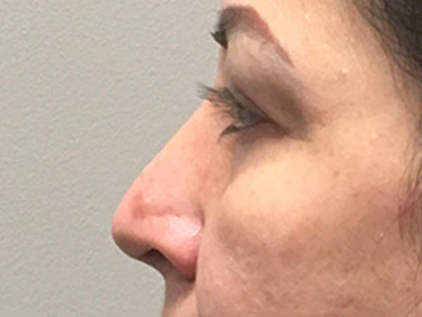 Injectables And Fillers 05