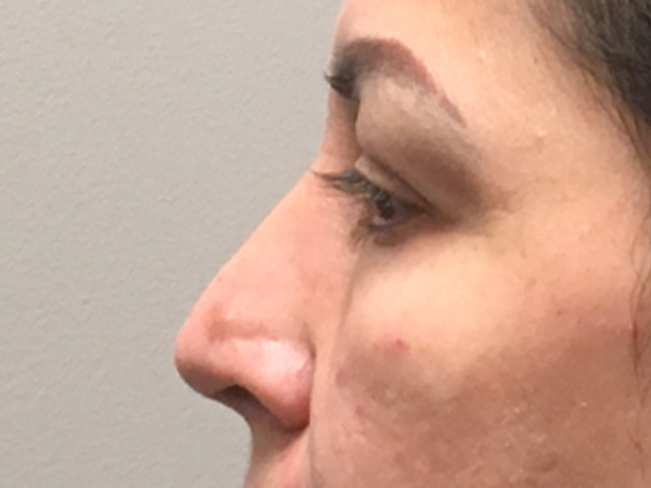 Injectables And Fillers 05