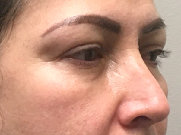 Injectables And Fillers 07