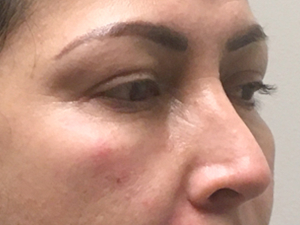 Injectables And Fillers 07