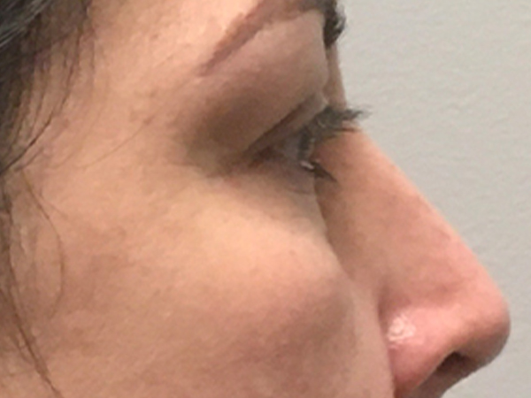 Injectables And Fillers 09