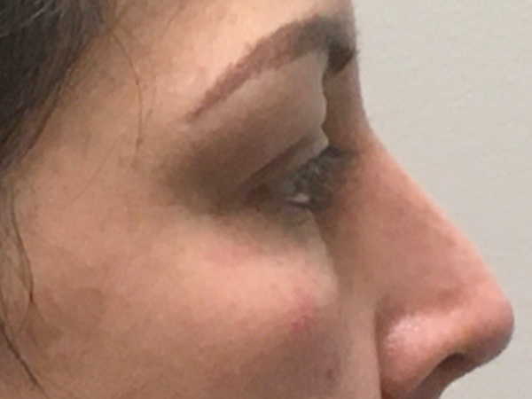 Injectables And Fillers 09