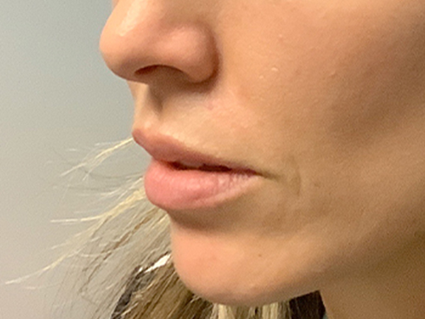 Injectables And Fillers 03