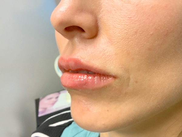 Injectables And Fillers 03