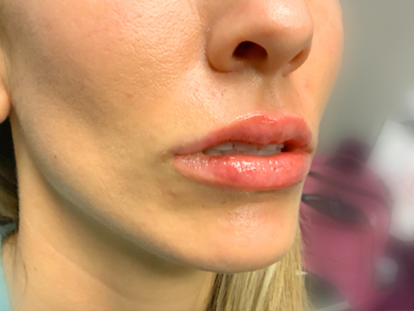 Injectables And Fillers 05