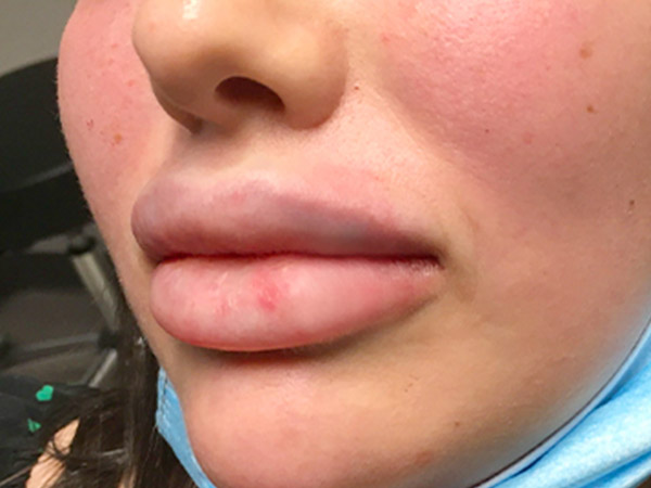 Injectables And Fillers 05