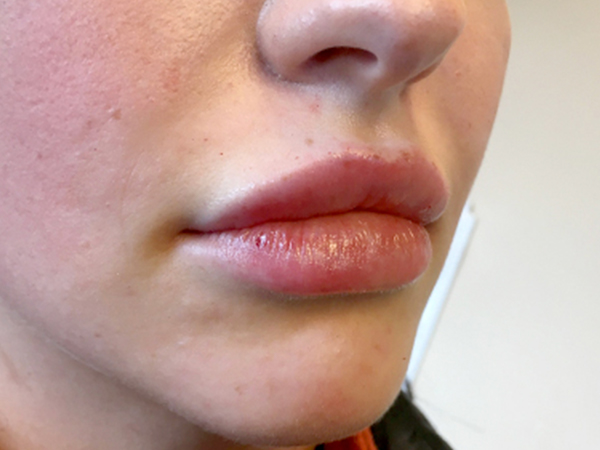 Injectables And Fillers 03