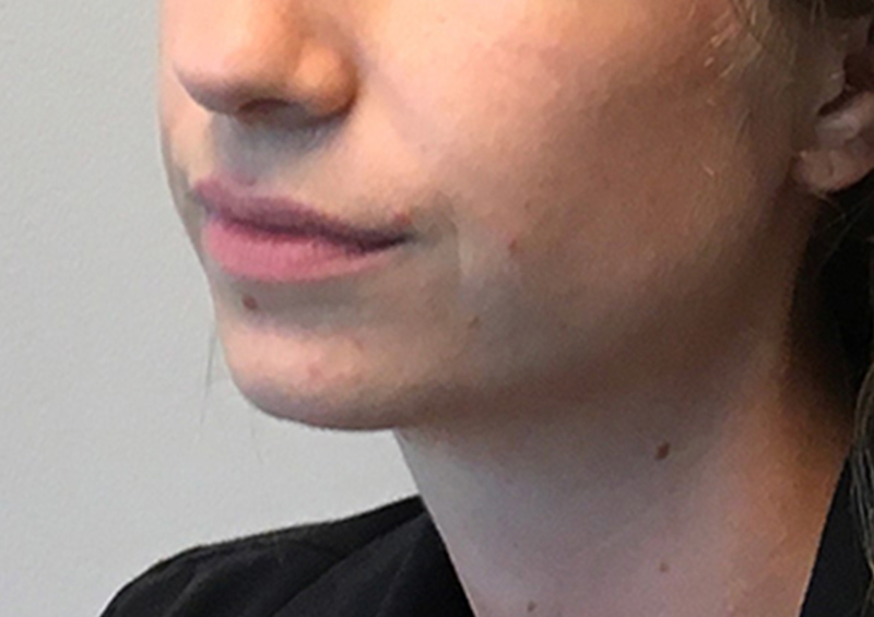 Injectables And Fillers 03