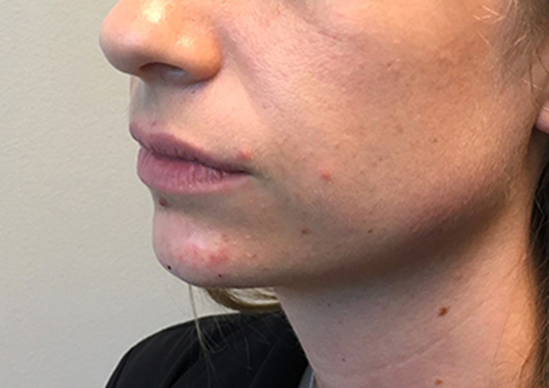 Injectables And Fillers 03