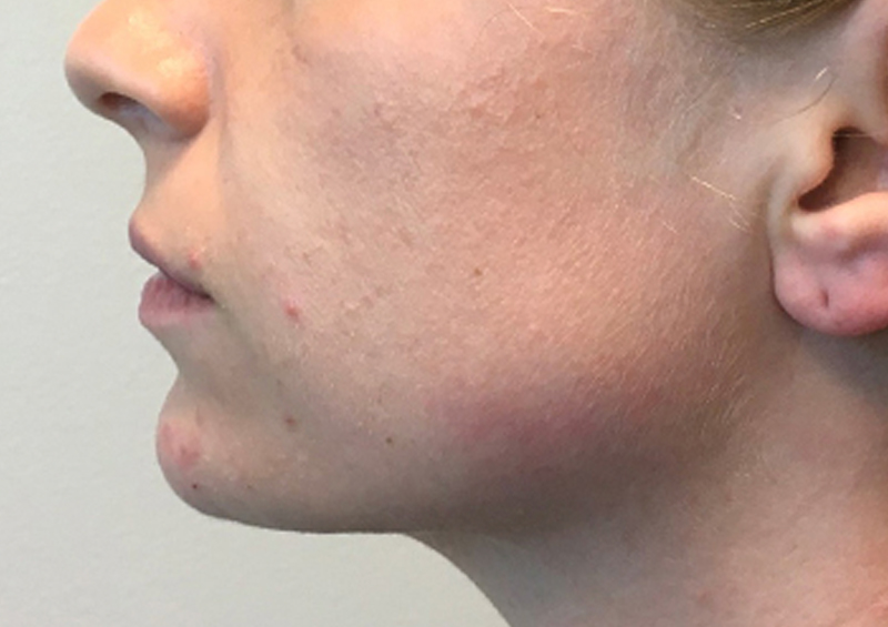 Injectables And Fillers 05