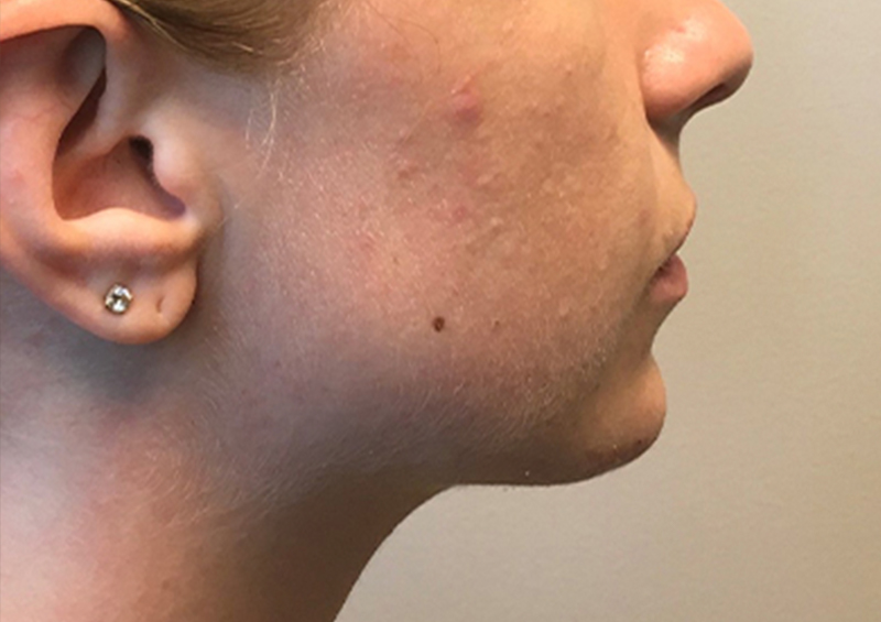 Injectables And Fillers 07