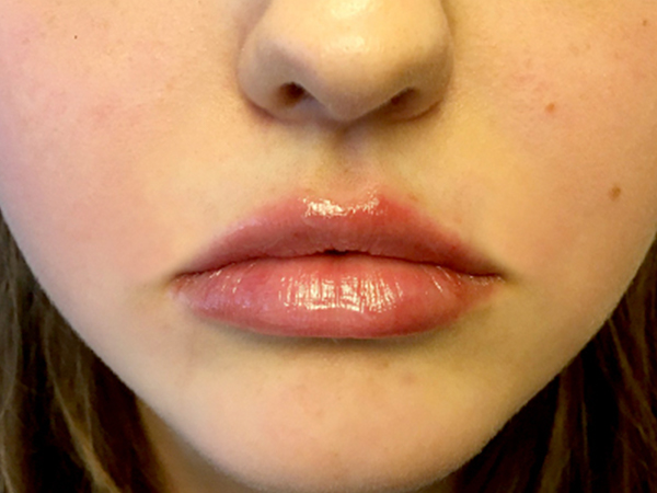 Injectables And Fillers 159