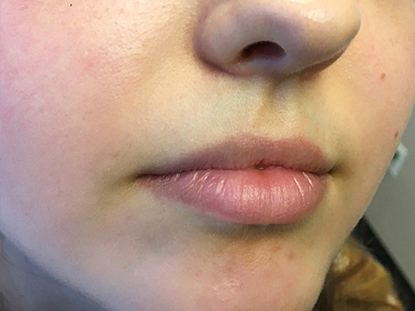 Injectables And Fillers 05