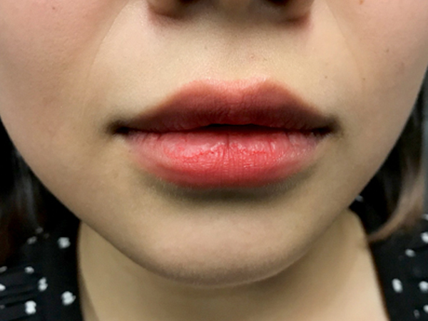 Injectables And Fillers 01