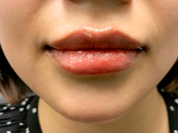 Injectables And Fillers 160