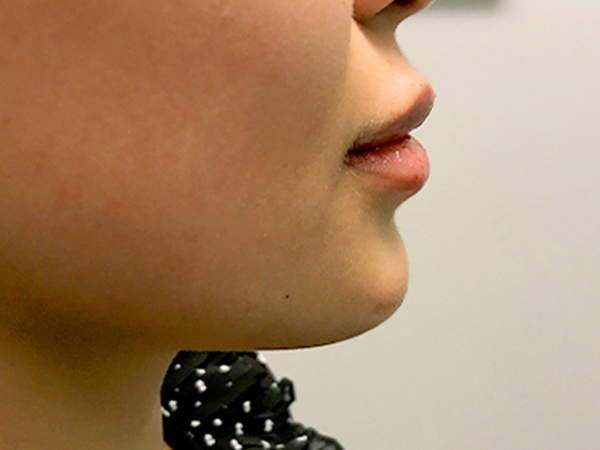 Injectables And Fillers 07