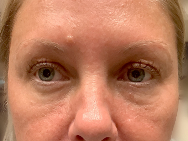 Injectables And Fillers 162