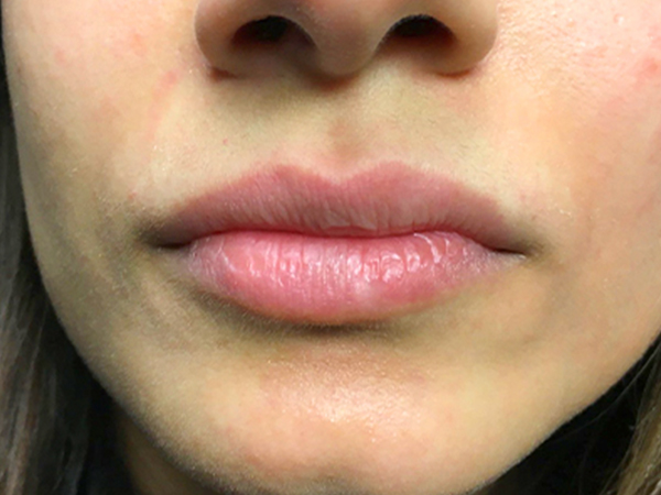 Injectables And Fillers 01