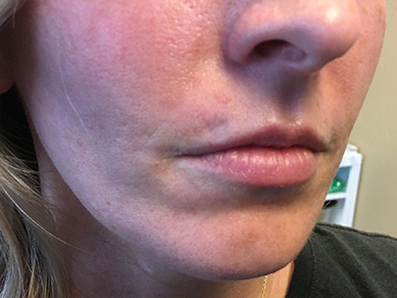 Injectables And Fillers 05