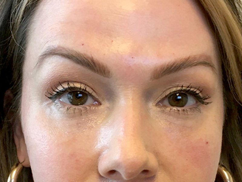 Injectables And Fillers 167